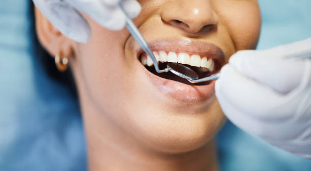 Best Urgent Care for Lost Fillings or Crowns in Stoughton, WI